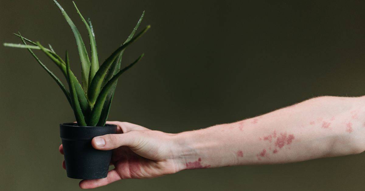 Aloe Vera