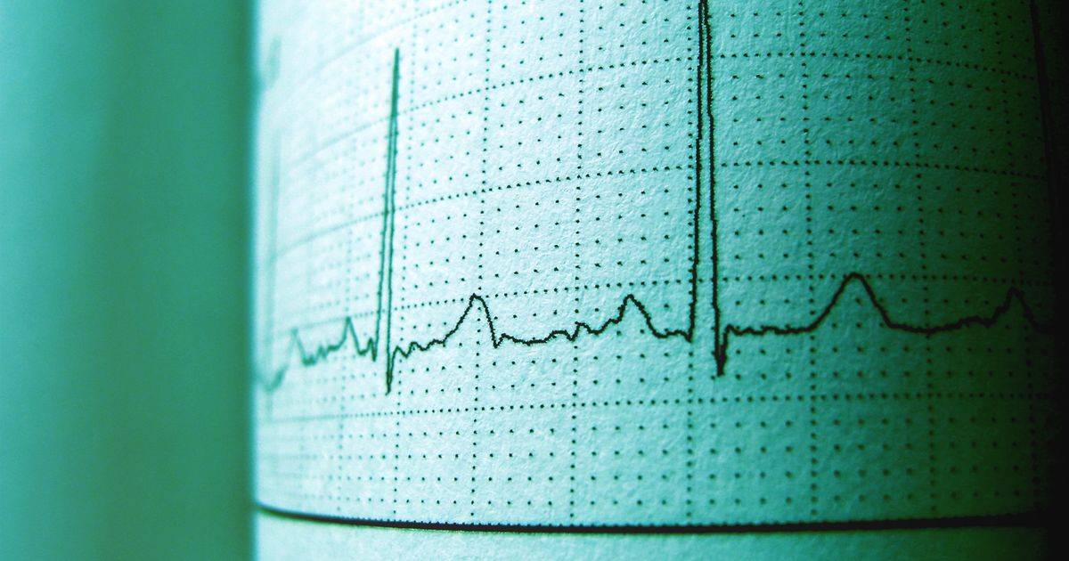 hs CRP Heart Disease: How Inflammation Drives Plaque