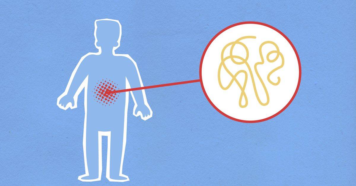 Subtle Signs Of An Unhealthy Gut You Should Not Ignore